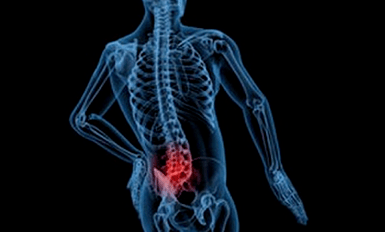 Die Gründe für die Entwicklung der lumbalen Osteochondose