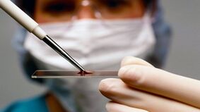 Diagnose von Arthrotten und Arthrose