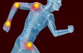 Die Gründe für die Entwicklung von Arthronen und Arthrose