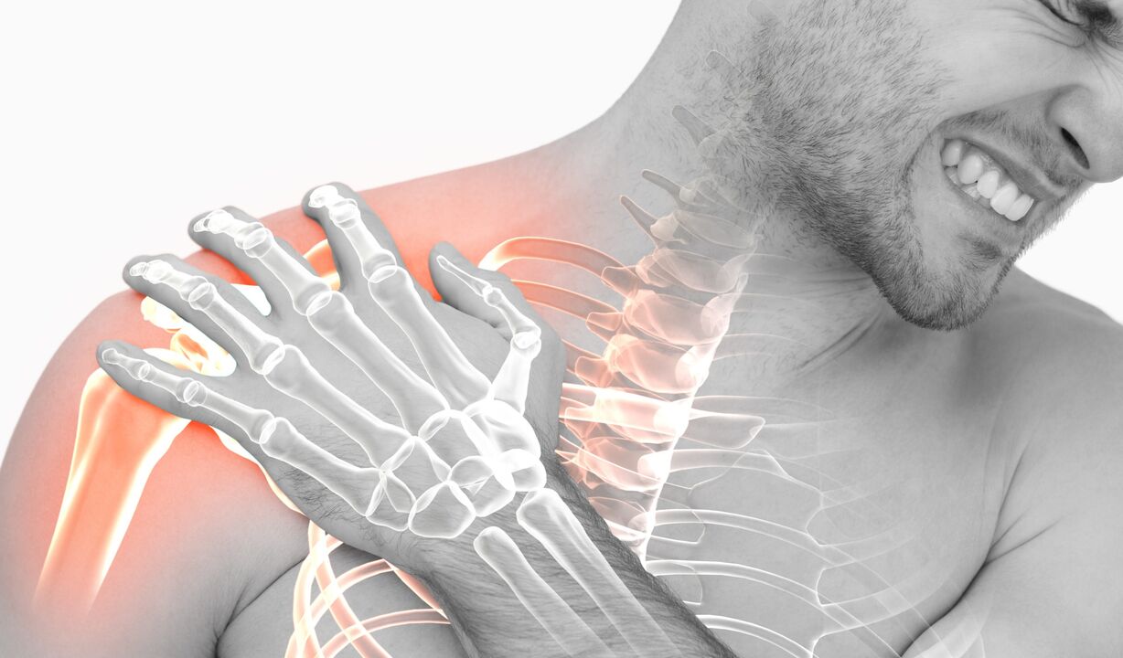 Schulterschmerzen aufgrund von Arthrose